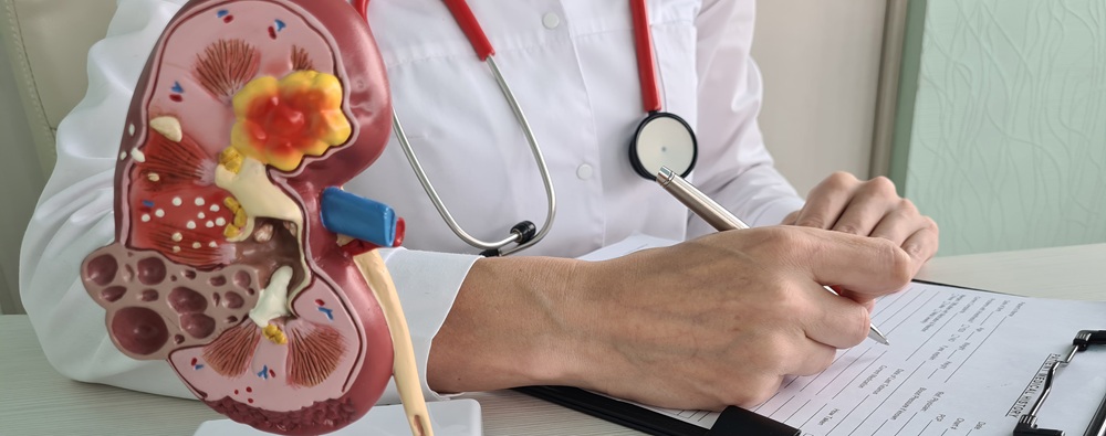 Digital illustration of kidney function highlighting nephrology and renal health at Nephron Kidney Centre