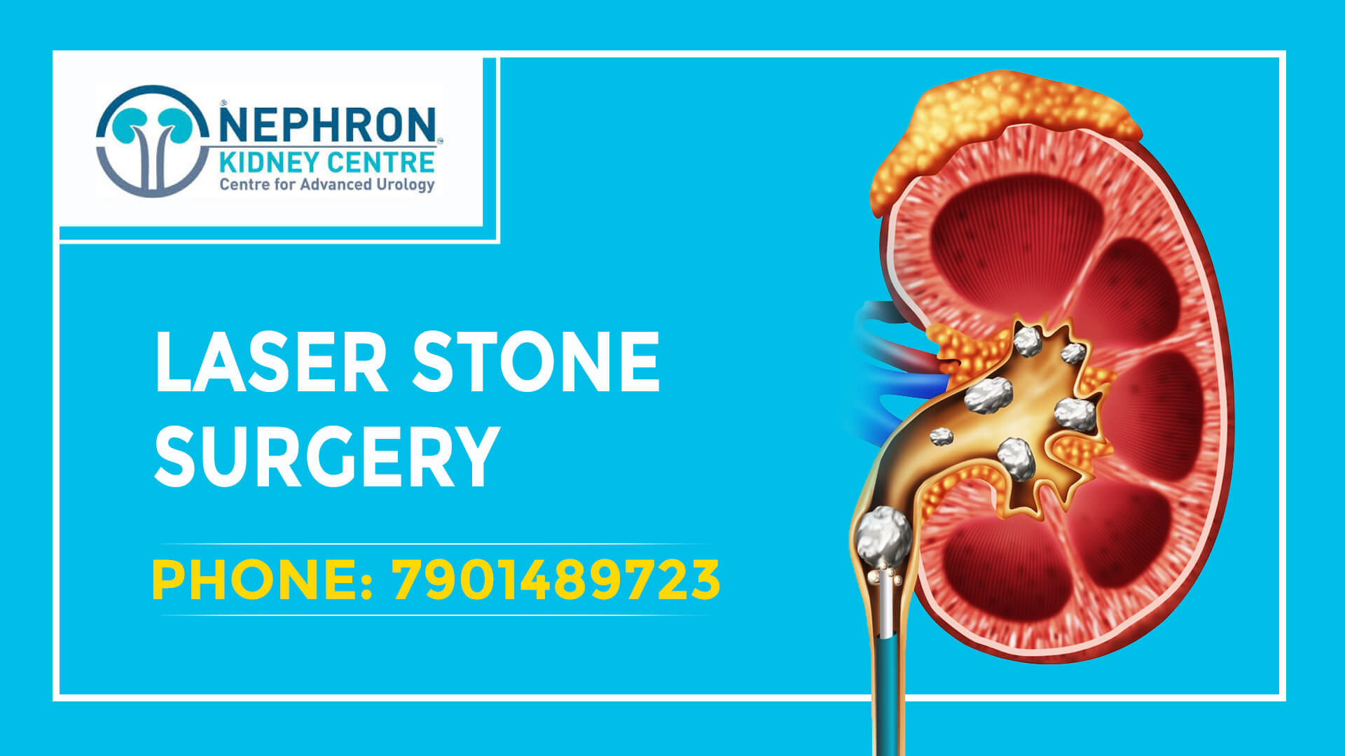 Nephron Kidney Centre – Advanced Urology